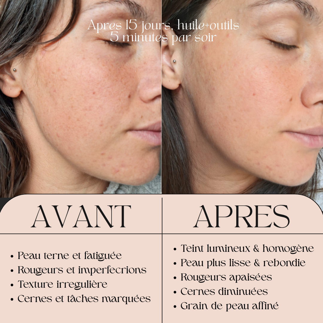 Le-jour-où-j-ai-arrêté-de-me-battre-contre-ma-peau-tout-a-changé. Okigaï